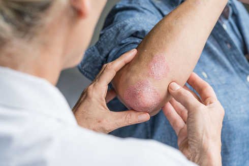 Malattie infiammatorie